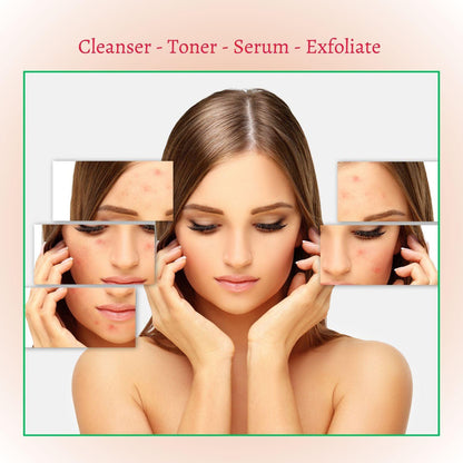 Gymsegbë - Deep Treatment Acne Cleansing Foam Cleanser