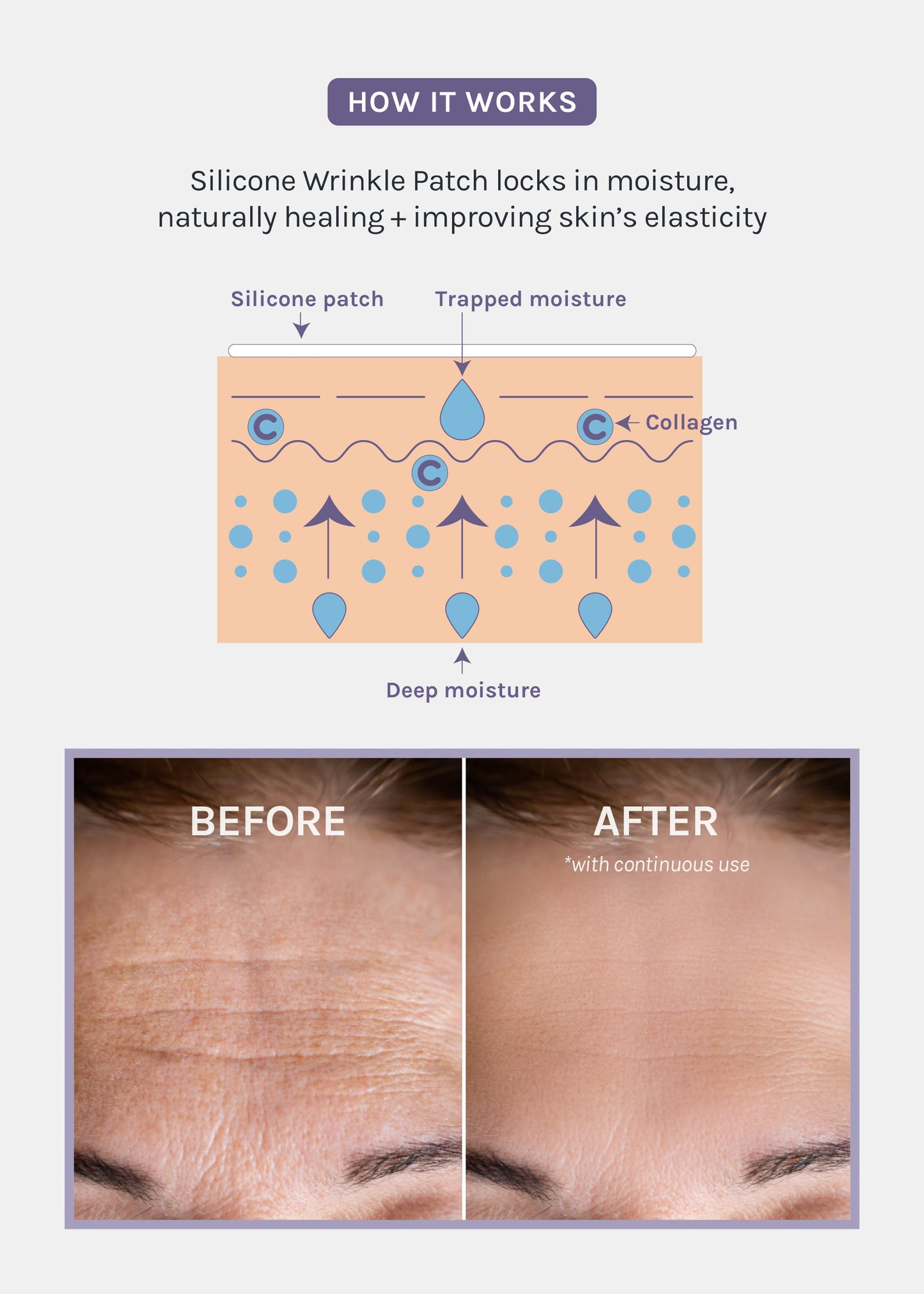 AOA Skin Wrinkle Smoothing Patch – Forehead