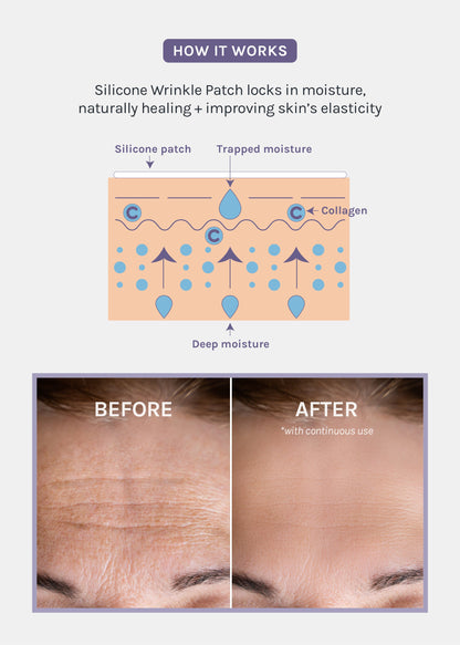 AOA Skin Wrinkle Smoothing Patch – Forehead