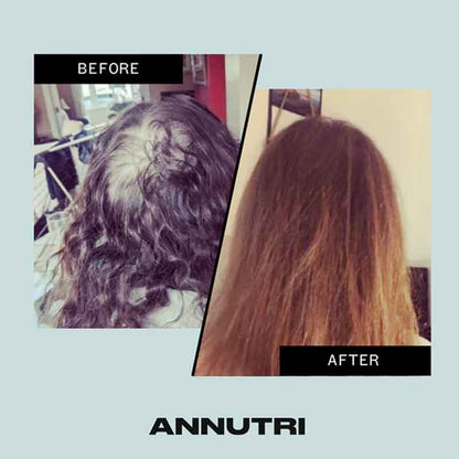 Annutri Grow It Hair Growth Supplement - 1 Month Supply