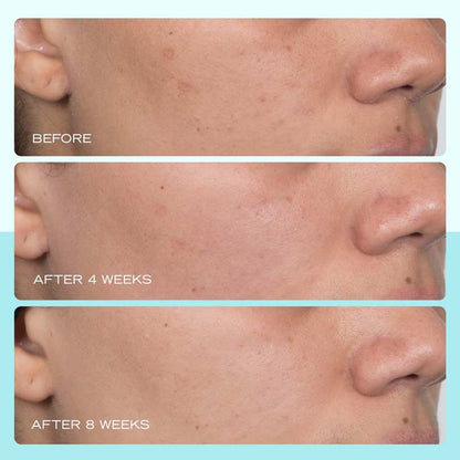 First Aid Beauty Dark Spot Serum with Niacinamide Discontinued