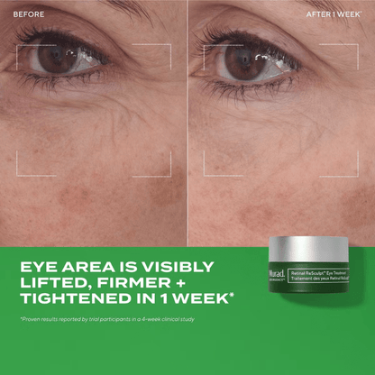 Murad Retinal ReSculpt Eye Treatment